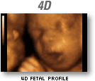 4D fetal profile