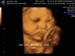 3D 4D
                              Ultrasound Sonoma Image