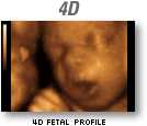 4D fetal
profile